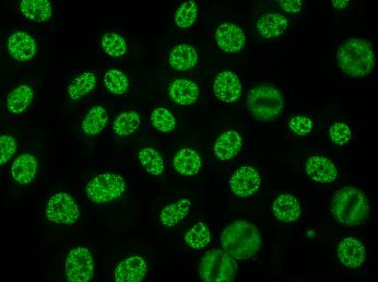 Speckles in the nucleus of interphase cells