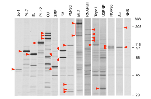 Analysis of protein components of autoantigens (8% SDS-PAGE).  35S-methionine labeled K562 cell extract was immunoprecipitated by prototype human autoimmune sera or normal human serum (NHS). Components of each autoantigen are indicated by red arrowheads.