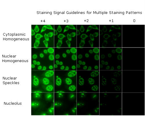 ANA staining intensity reference gallery Staining Signal Guidelines for Multiple Staining Patterns