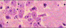 Images used in diagnosing diseases