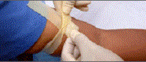 Proper procedure for extracting blood