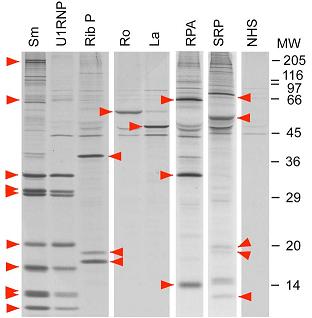 Analysis of protein components of autoantigens (12.5% SDS-PAGE). 35S-methionine labeled K562 cell extract was immunoprecipitated by prototype human autoimmune sera or normal human serum (NHS). Components of each autoantigen are indicated by red arrowheads.