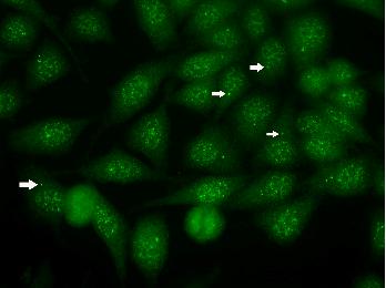 Distinct dots (2-4/cell) in cytoplasm and at the poles of mitotic spindle