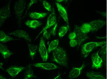 Cytoskeleton staining with variable intensity interphase cells