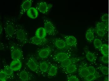 Discrete dots in cytoplasm of interphase cells