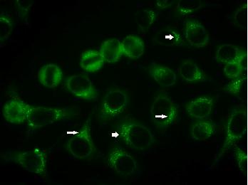 Discontinuous speckled or granular perinuclear staining