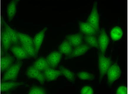 Uniform diffuse staining of the cytoplasm in interphase