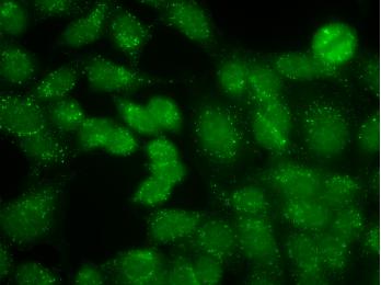 Distinct and bright speckled staining irregularly distributed in the cytoplasm