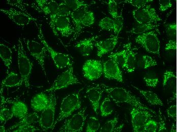 Coarse granular filamentous staining