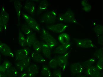 Distinct rod and ring structures throughout the cytoplasm