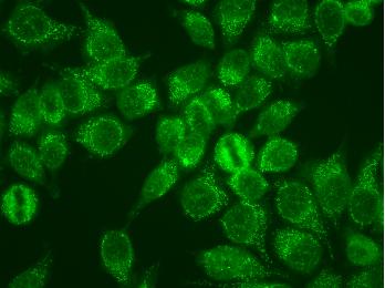 Speckles Speckled staining of the cytoplasm