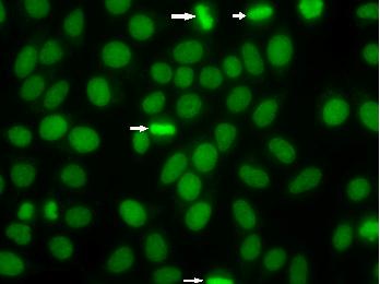 Diffuse staining of condensed chromatin in mitotic cells