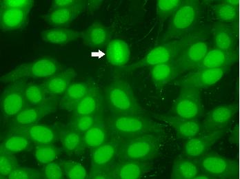  Uniform diffuse staining of the mitotic cytoplasm 