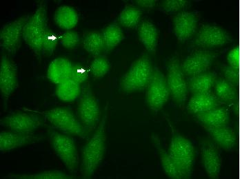  Staining of the intercellular bridge that connects daughter cells by the end of cell division, but before cell separation