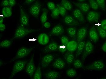 Speckles Numerous speckles in cytoplasm of mitotic cells