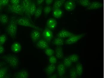 The spindle fibers between the poles are stained in mitotic cells, associated 