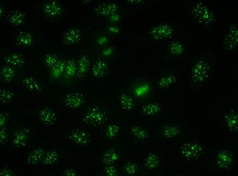 Discrete speckles (40-80/cell) in interphase cells and on metaphase plates