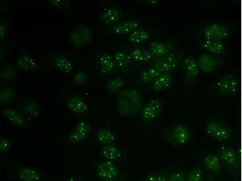 Countable discrete speckles PML bodies, Cajal bodies (coiled bodies)