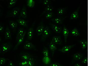 Homogeneous or speckled staining of the nucleolus