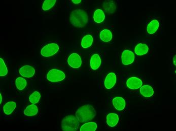 Homogeneous Uniform diffuse staining of the nucleus in interphase cells