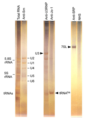 Analysis of RNA components of autoantigens. K562 cell extract from 107 cells was immunoprecipitated by prototype sera for anti-U3RNP, Jo-1, and normal human serum (NHS). RNA component was extracted and analyzed by urea-PAGE and silver staining. RNA components of each autoantigen are shown with arrowheads. Total RNA and the pattern by anti-Sm serum are shown as references.