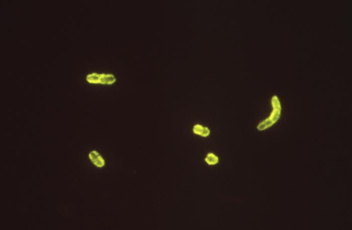 Micrografia de bactérias Yersinia pestis, agente causador da peste