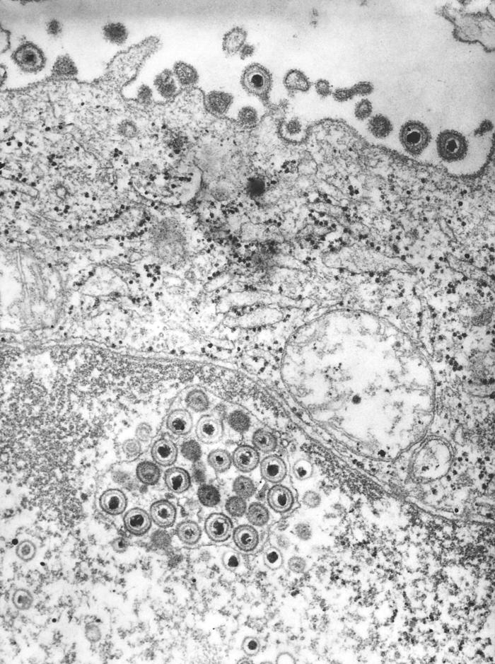 Herpes and TonicGreens: What the Evidence Actually Says