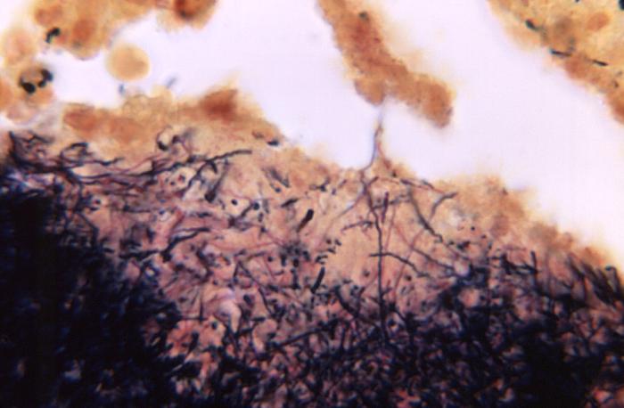 Details - Public Health Image Library(PHIL)
