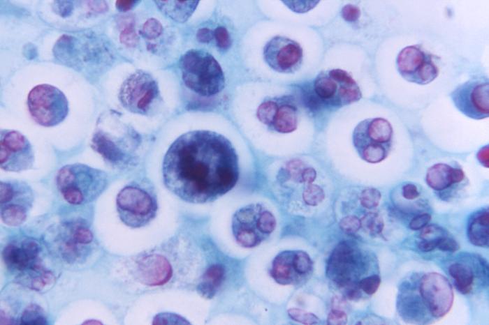 CDC public-domain macrophage activation image used as the macrophage-side anchor for iron recycling