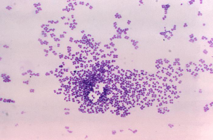 Details - Public Health Image Library(PHIL)