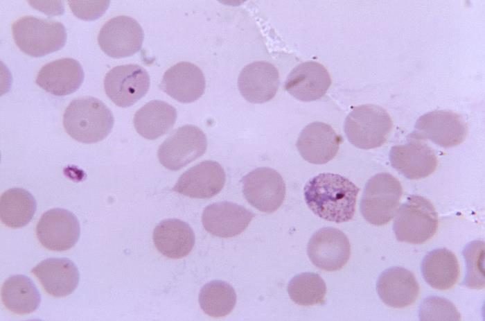 Details - Public Health Image Library(PHIL)