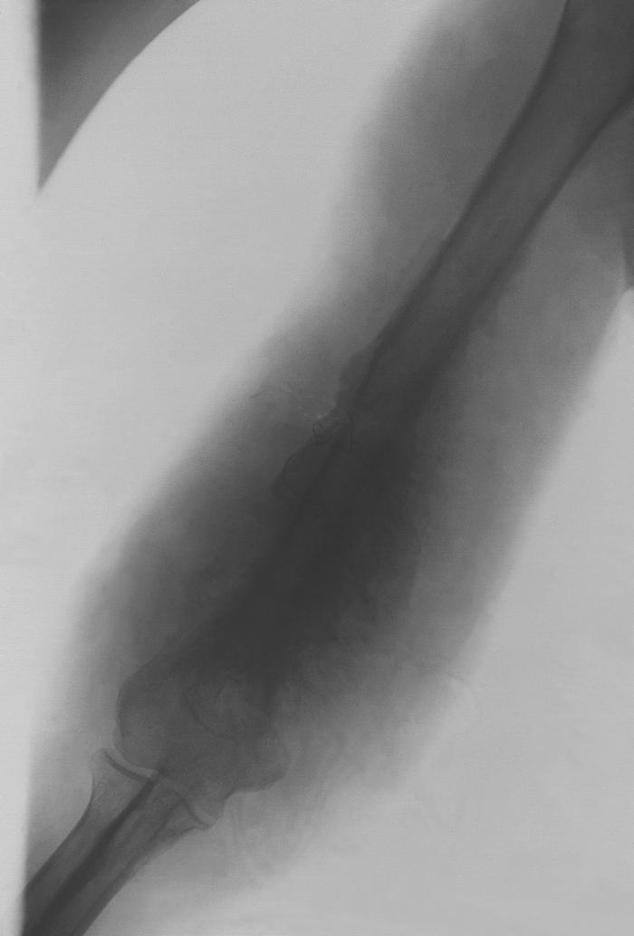 Details - Public Health Image Library(PHIL)
