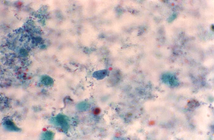 Stained Specimen Details - Public Health Image Library(PHIL)