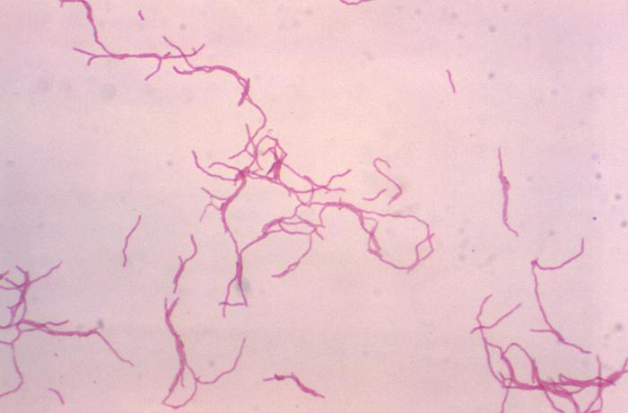 Details Public Health Image Library PHIL details-public-health-image-library-phil