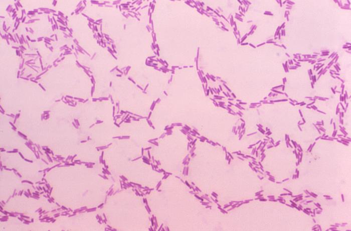 Details - Public Health Image Library(PHIL)