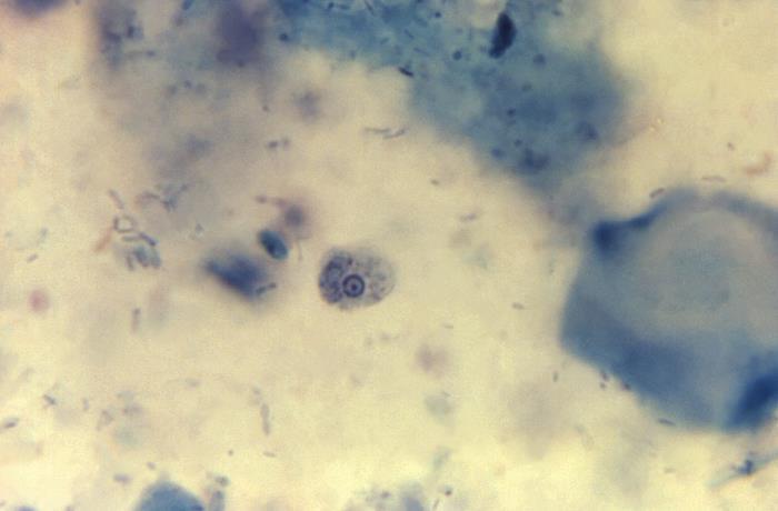 Stained Specimen Details - Public Health Image Library(PHIL)