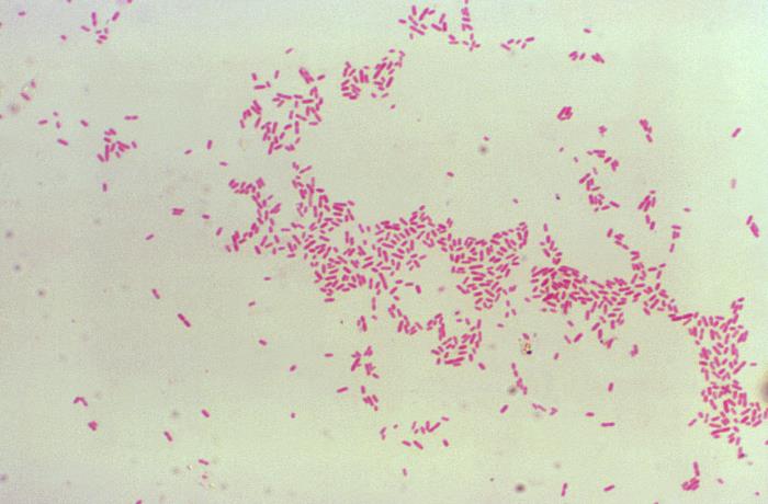 Details - Public Health Image Library(PHIL)