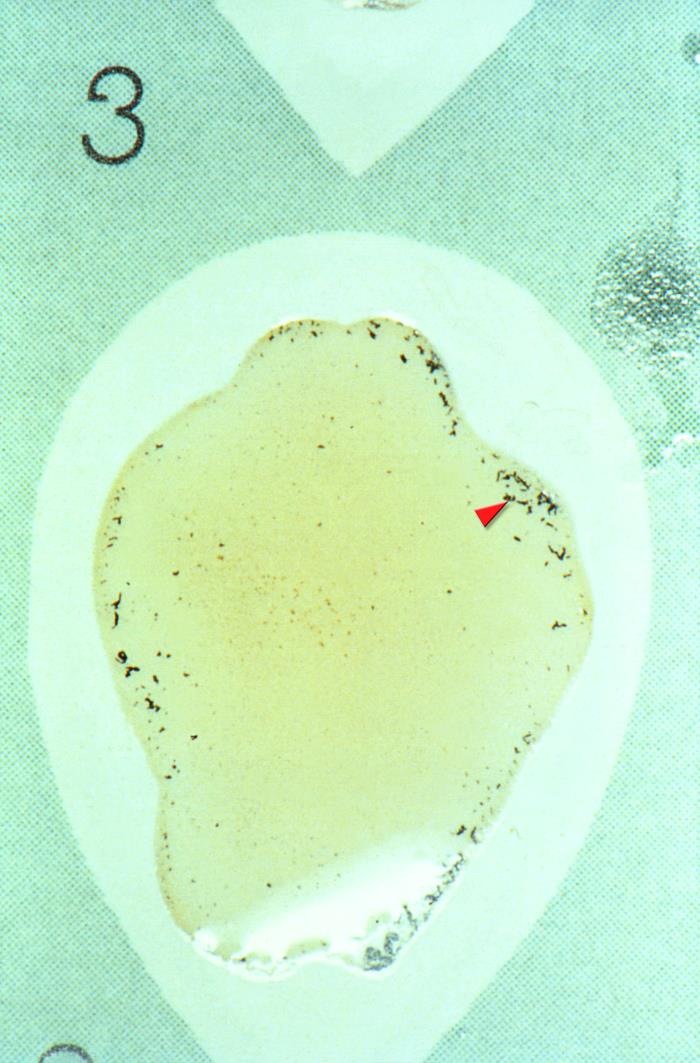 Details - Public Health Image Library(PHIL)