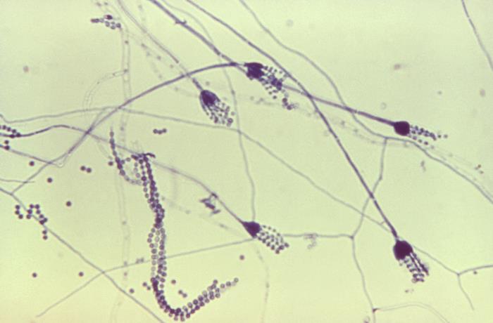 Details - Public Health Image Library(PHIL)