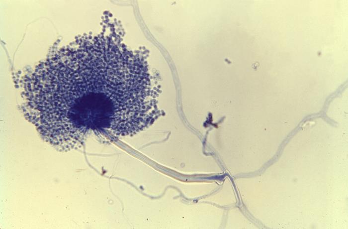Details - Public Health Image Library(PHIL)