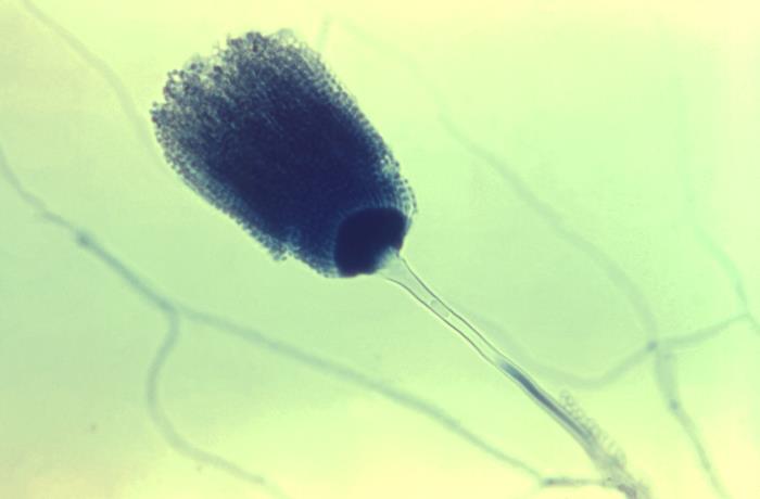 Details - Public Health Image Library(PHIL)