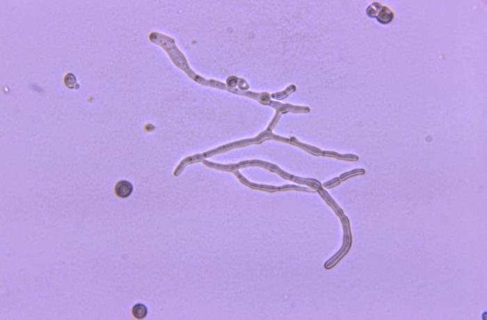 Details - Public Health Image Library(PHIL)