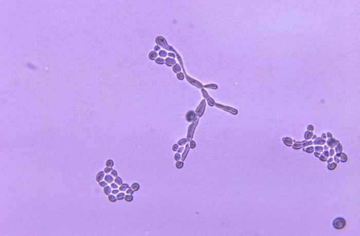 Details - Public Health Image Library(PHIL)