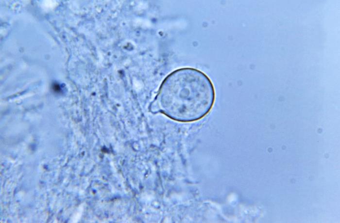 Details - Public Health Image Library(PHIL)