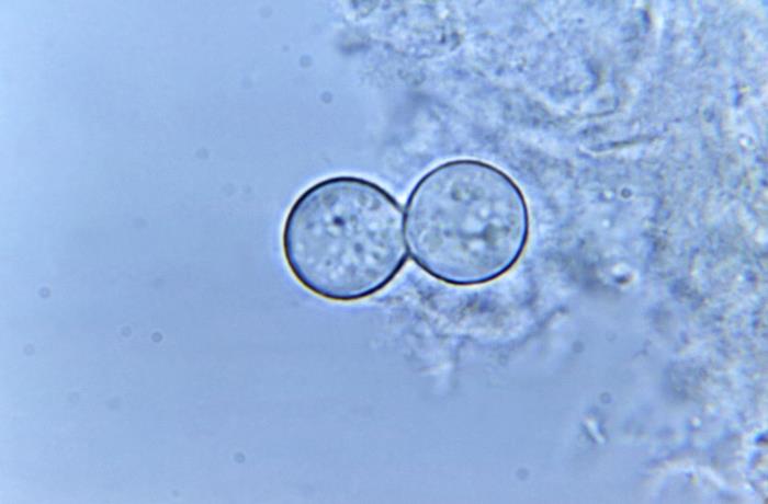 Details - Public Health Image Library(PHIL)