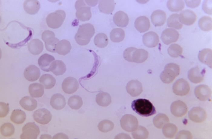 Details - Public Health Image Library(PHIL)