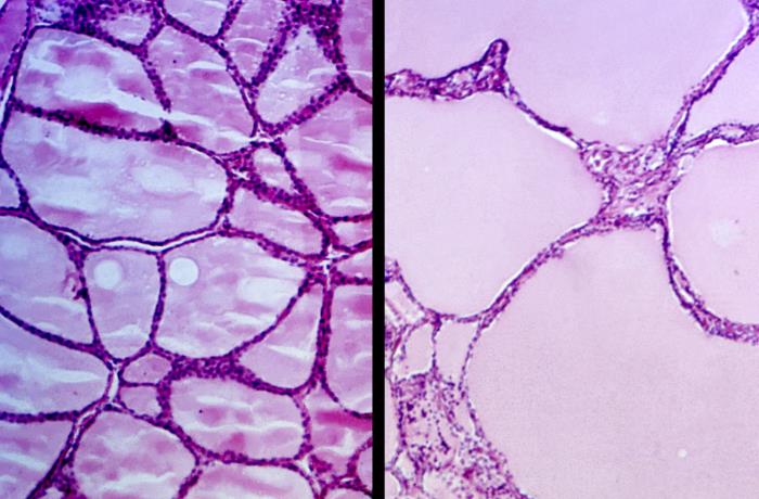 Details - Public Health Image Library(PHIL)