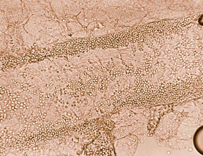 Details - Public Health Image Library(PHIL)