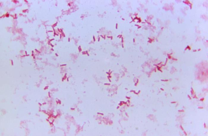 Details - Public Health Image Library(PHIL)