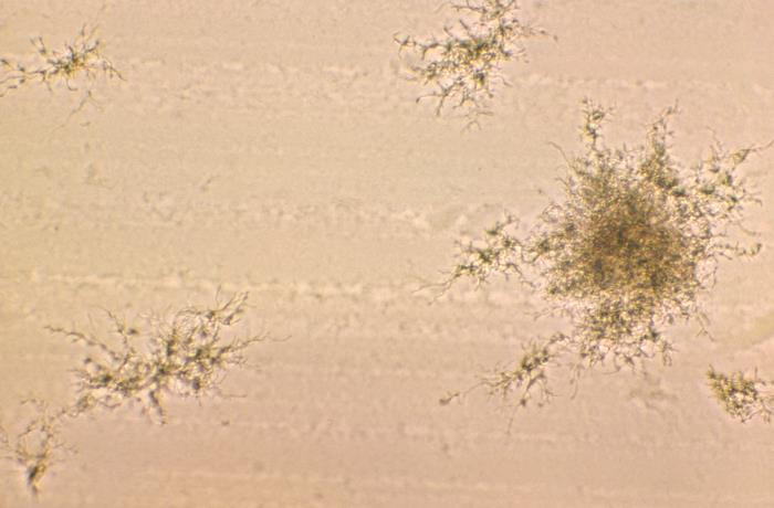 Pathologic Spider Details - Public Health Image Library(PHIL)